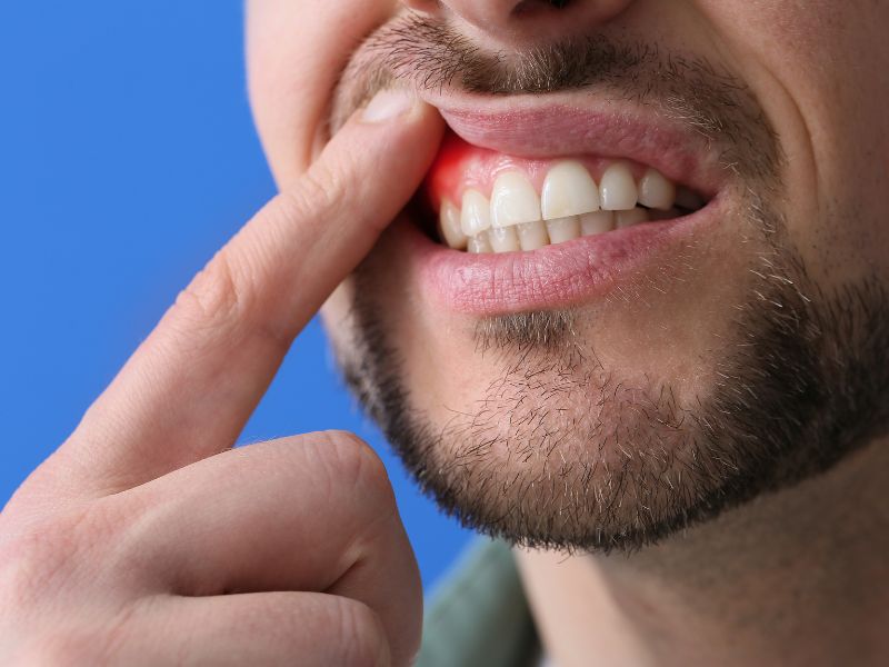 Periodontia | Premiere Odontologia